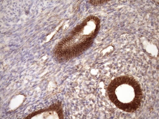 CTNNB1 / Beta Catenin Antibody (aa29-118, clone OTI2F10)