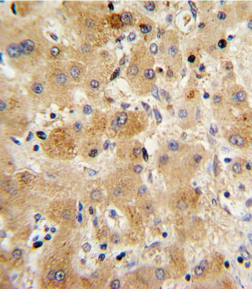 TTR / Transthyretin Antibody (aa47-74)
