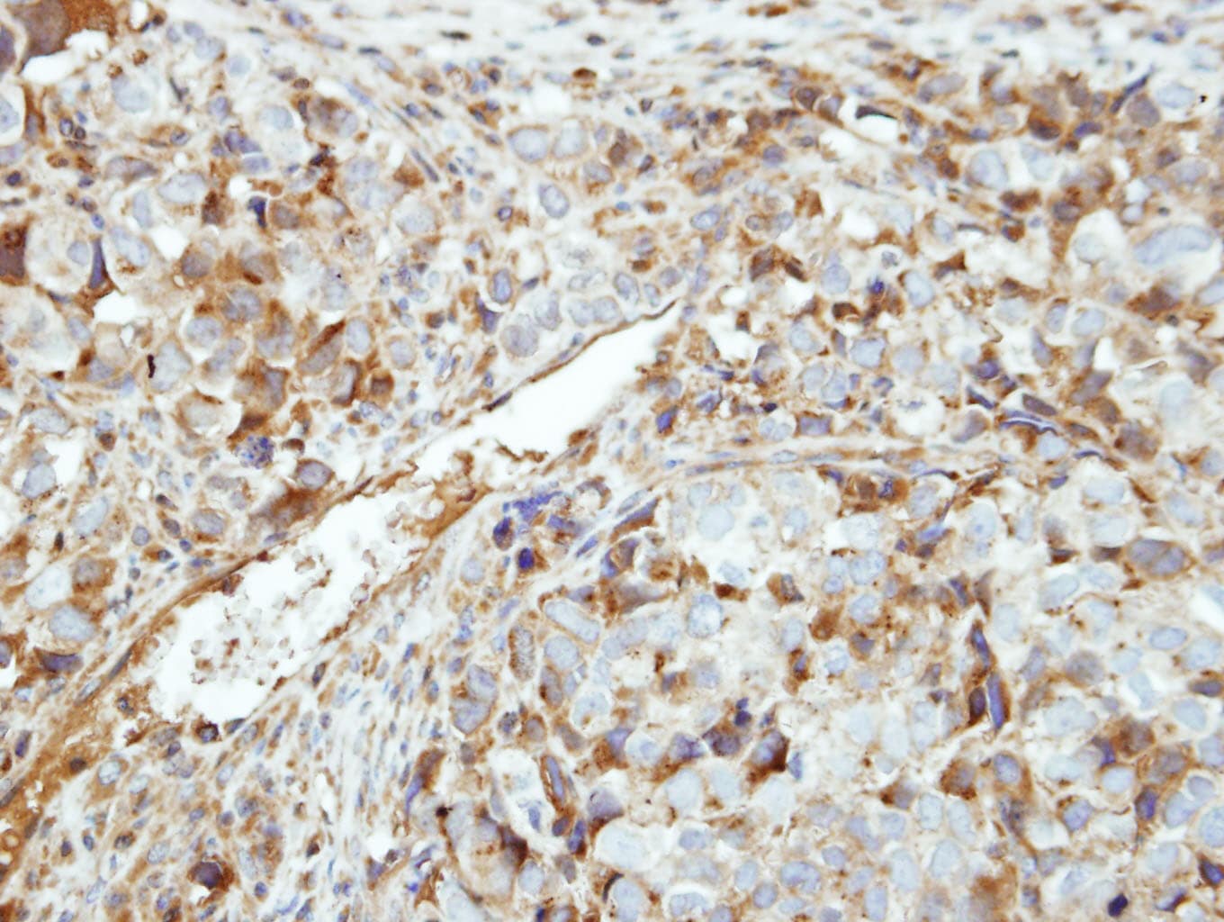 Polyclonal Rabbit anti-Human GK5 Antibody (aa9-297, IHC, WB)