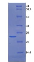Human GAS6 Protein (Recombinant His)
