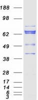 Human PRKCB / PKC-Beta Protein (Recombinant Myc-DDK (Flag))