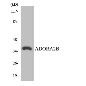 ADORA2B/Adenosine A2B Receptor Antibody (aa221-270)