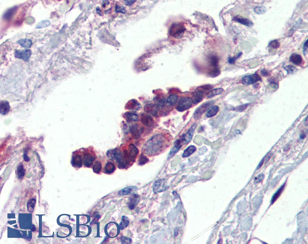 BPIFA1 / SPLUNC1 Antibody (aa101-150)