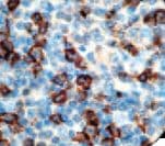 CD45 / LCA Antibody (clone 2B11 & PD7/26)