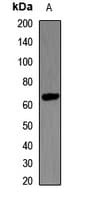 LCAT Antibody