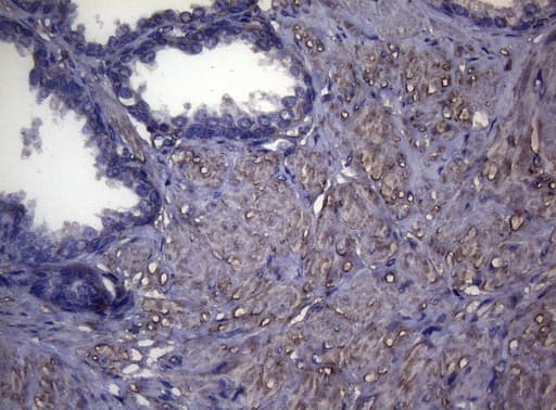 MAK Antibody (aa291-623, clone OTI5A7)