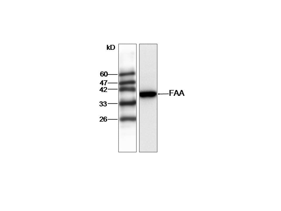 IHC-plus™ FAH Antibody
