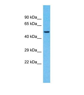 CASC4 Antibody (aa69-118)