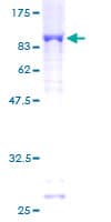 Human PARP3 Protein (Recombinant GST)