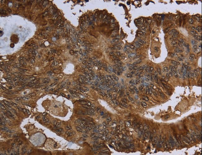 Polyclonal Rabbit anti-Human 15-PGDH / HPGD Antibody (IHC)