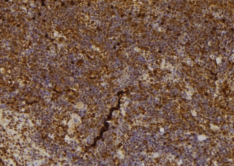 Polyclonal Rabbit anti-Human NOS2 / iNOS Antibody (IHC, IF, WB)