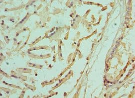 IHC-plus™ Polyclonal Rabbit anti-Human PSMD5 Antibody (aa255-504, IHC)