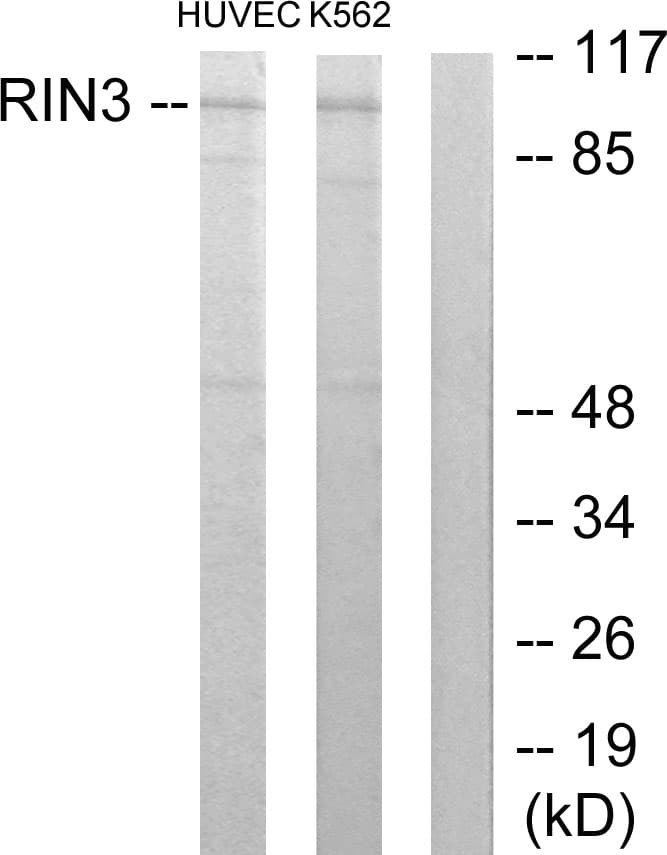 RIN3 Antibody (aa391-440)