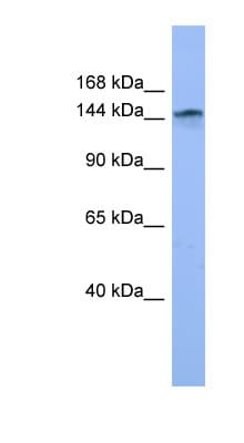 Polyclonal Rabbit anti-Human COL4A3 / Tumstatin Antibody (aa793-842, WB)