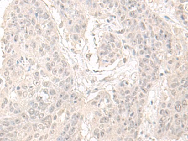 Polyclonal Rabbit anti-Human OLA1 Antibody (IHC)