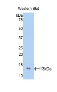 ATP4A Antibody (aa798-896, FITC)