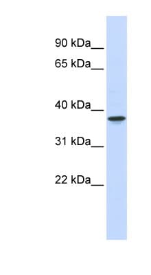 Polyclonal Rabbit anti-Human THOC6 Antibody (aa144-193, WB)