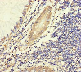 Polyclonal Rabbit anti-Human HYPM / CXorf27 Antibody