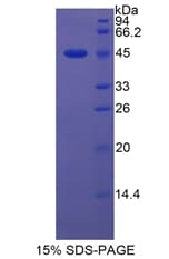 Rat Lcn5 / Lipocalin 5 Protein (Recombinant His-GST)