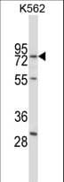 RPA70 / RPA1 Antibody (aa531-559)