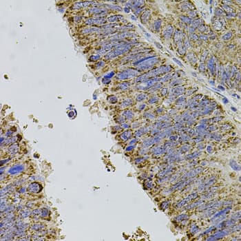 ALDH1A1 / ALDH1 Antibody