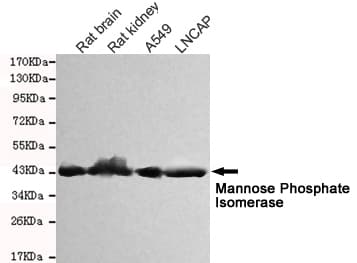 Monoclonal Mouse anti-Human Mannose Phosphate Isomerase Antibody (WB)