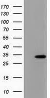 PECR Antibody (clone OTI1E12)