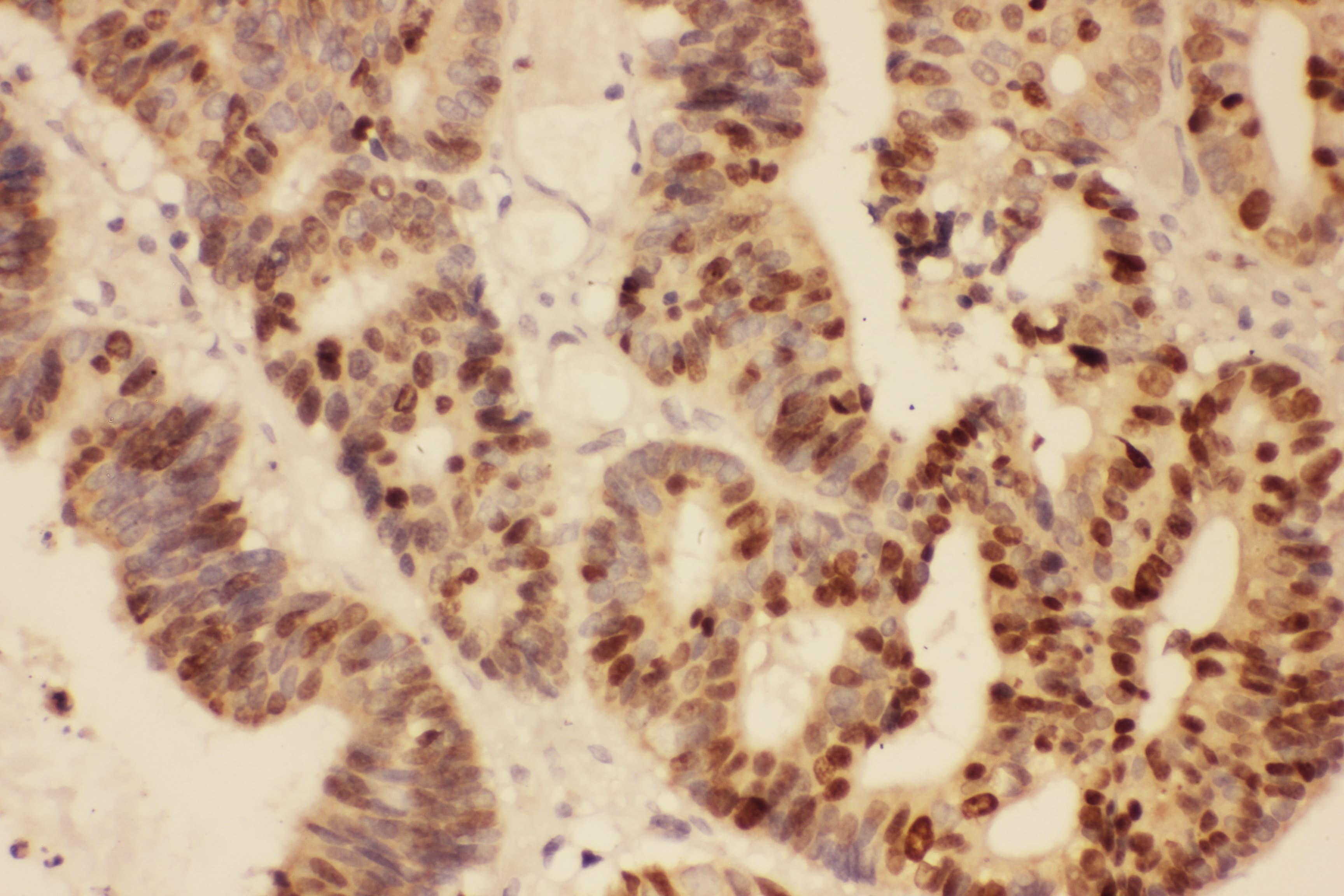 MKI67 / Ki67 Antibody (aa2860-3256)