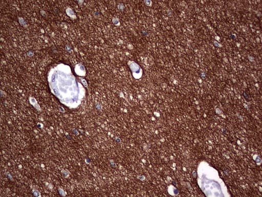 NCAM / CD56 Antibody (aa20-718, clone OTI1C7)