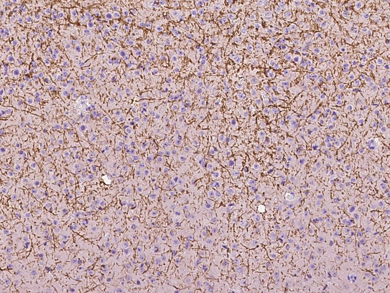Polyclonal Rabbit anti-Mouse NCAM / CD56 Antibody (Preservative Free, IHC)