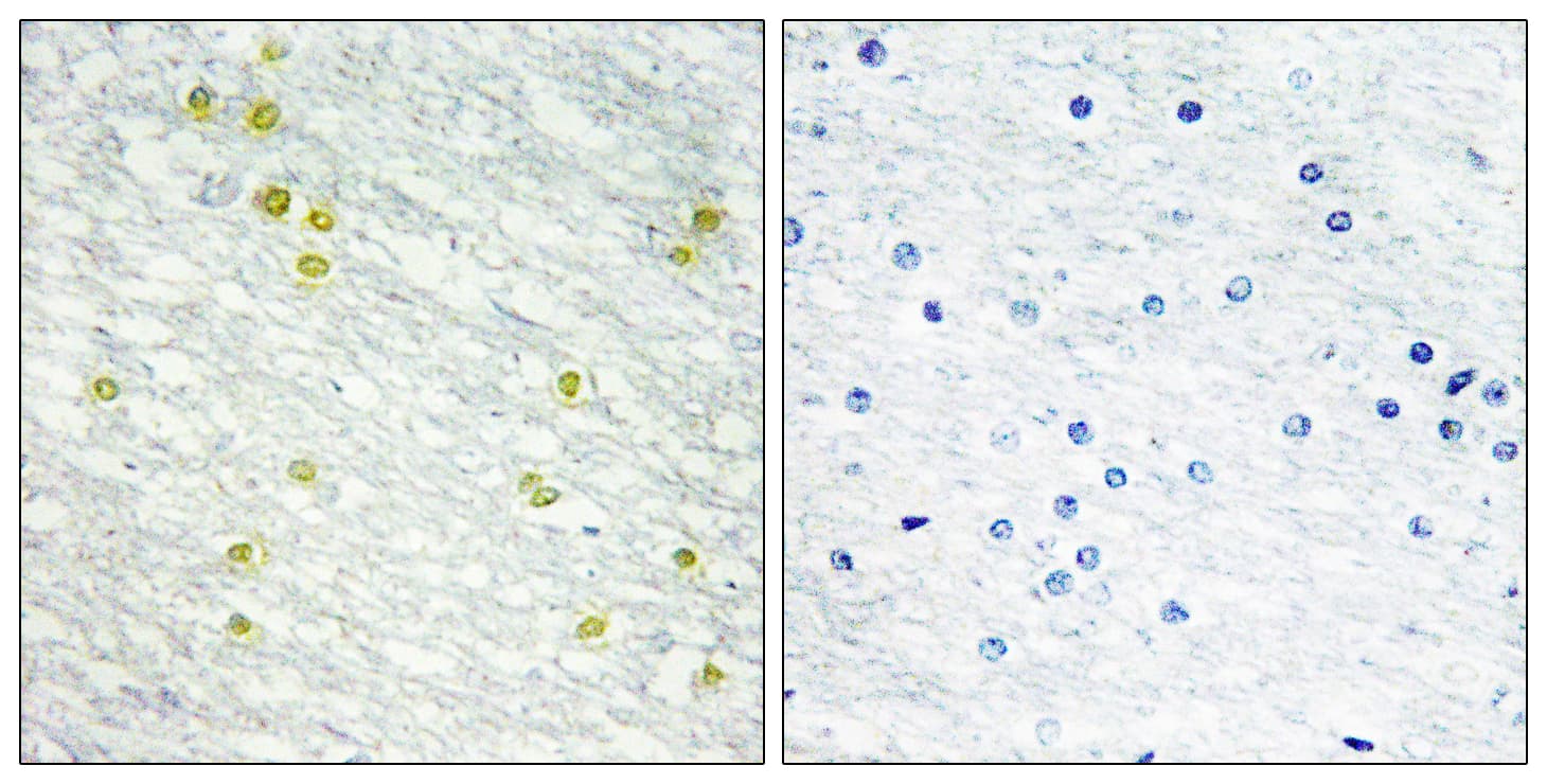 MED14 Antibody (aa701-750)