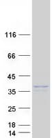 Human RAB36 Protein (Recombinant Myc-DDK (Flag))