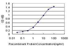 IHC-plus™ Monoclonal Mouse anti-Human CPS1 Antibody (clone 8H8, IHC, WB)