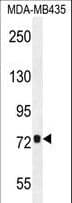 CCDC81 Antibody (aa380-408)