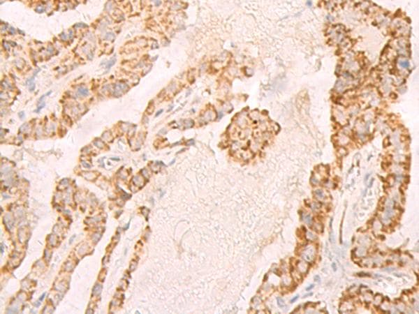 IL7R / CD127 Antibody