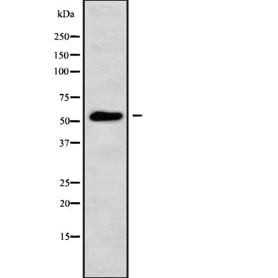 ANXA11 / Annexin XI Antibody