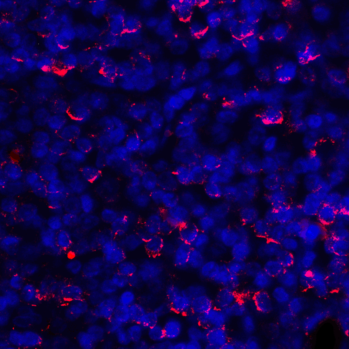 CD274 / B7-H1 / PD-L1 Antibody (clone 1F11)