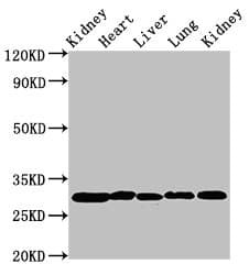 IHC-plus™ CA2 / Carbonic Anhydrase II Antibody (aa2-260)