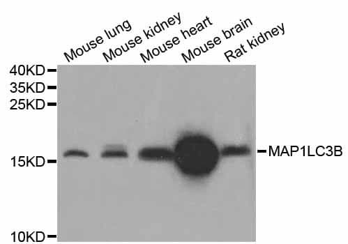 MAP1LC3B / LC3B Antibody