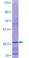 Human SPHAR Protein (Recombinant GST)
