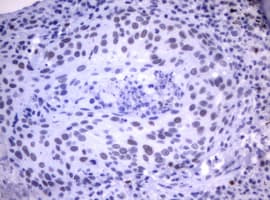 Monoclonal Mouse anti-Human MDM2 Antibody (clone OTI1E6, IHC, WB)