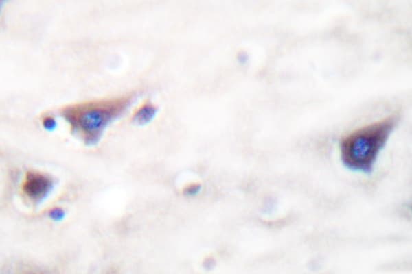 KSR1 Antibody (Arg386)