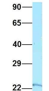 RPS5 / Ribosomal Protein S5 Antibody (C-Terminus)