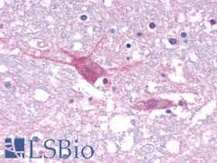 PathPlus™ GPR44 / CRTH2 Antibody (N-Terminus)