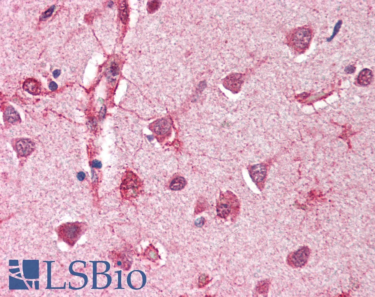 IHC-plus™ Polyclonal Rabbit anti-Human FANCC Antibody (IHC, WB)