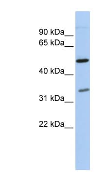 PQBP1 Antibody (aa72-121)