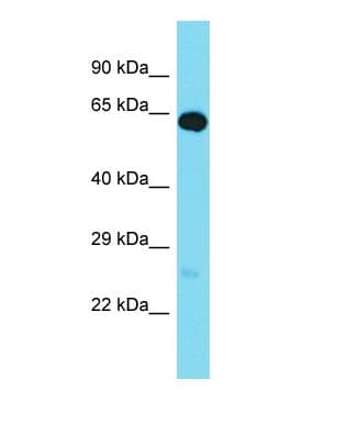 Polyclonal Rabbit anti-Human GPR162 Antibody (N-Terminus, WB)