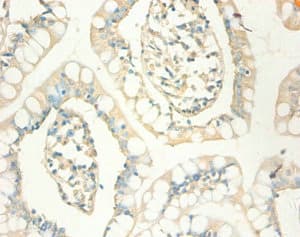 MT1X Antibody