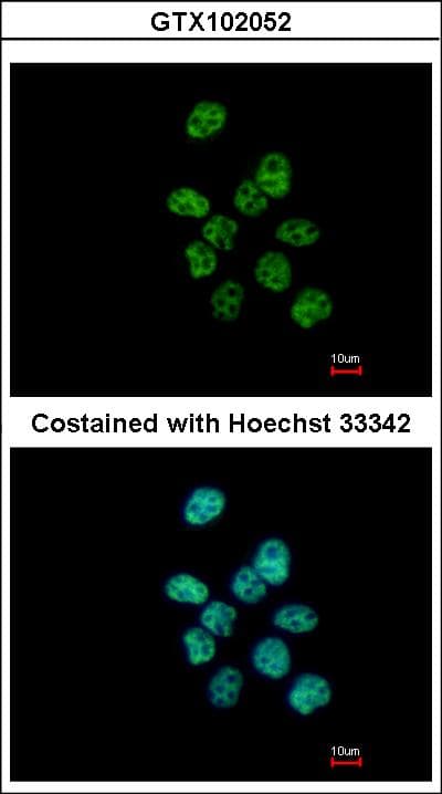 IHC-plus™ PUF60 Antibody (aa346-523)