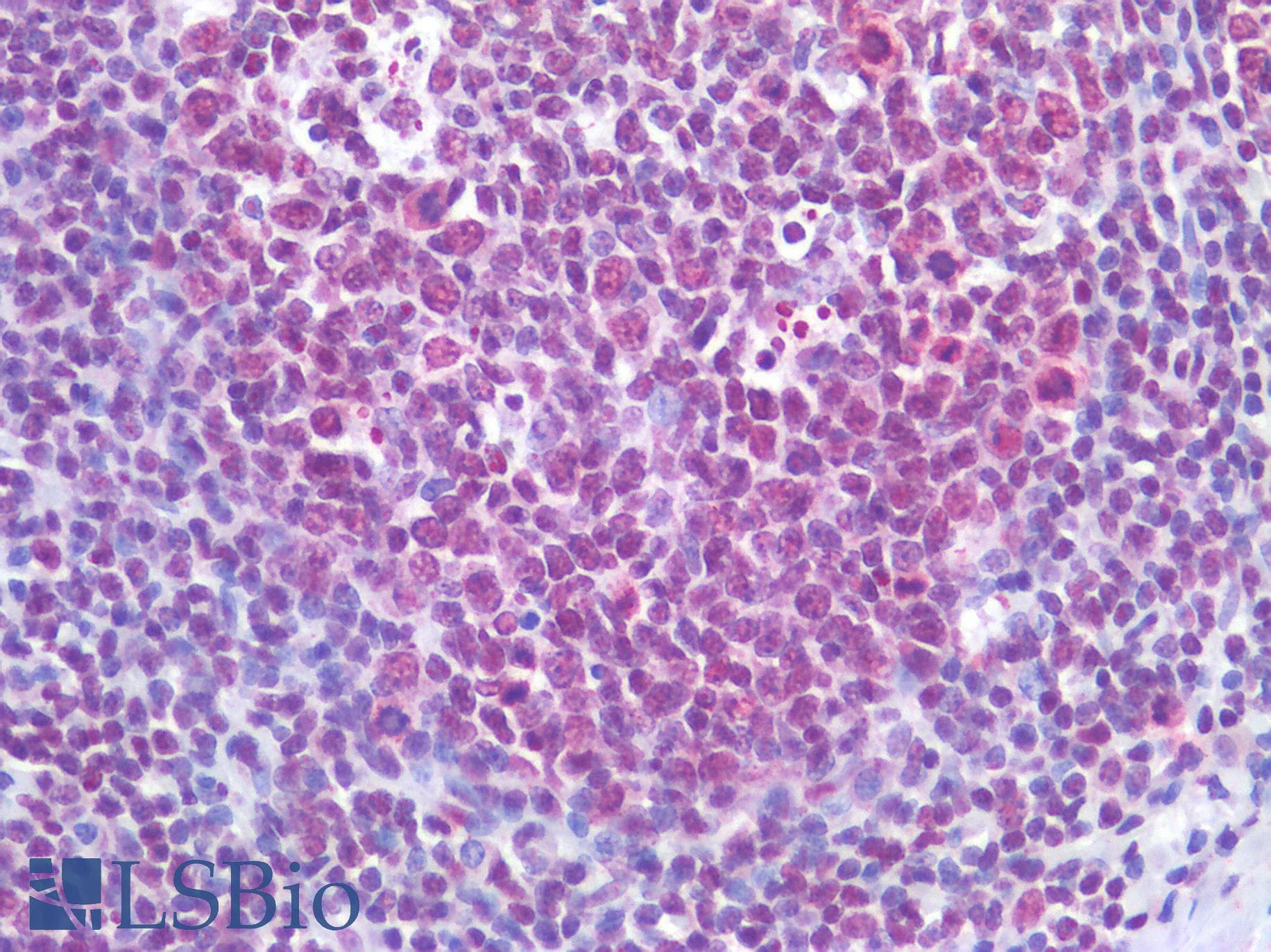 IHC-plus™ TERT / Telomerase Antibody
